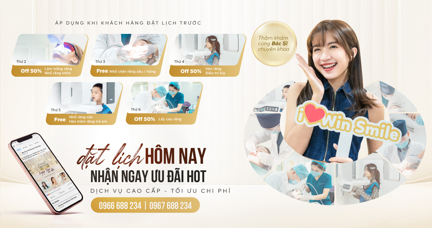 Banner mobile